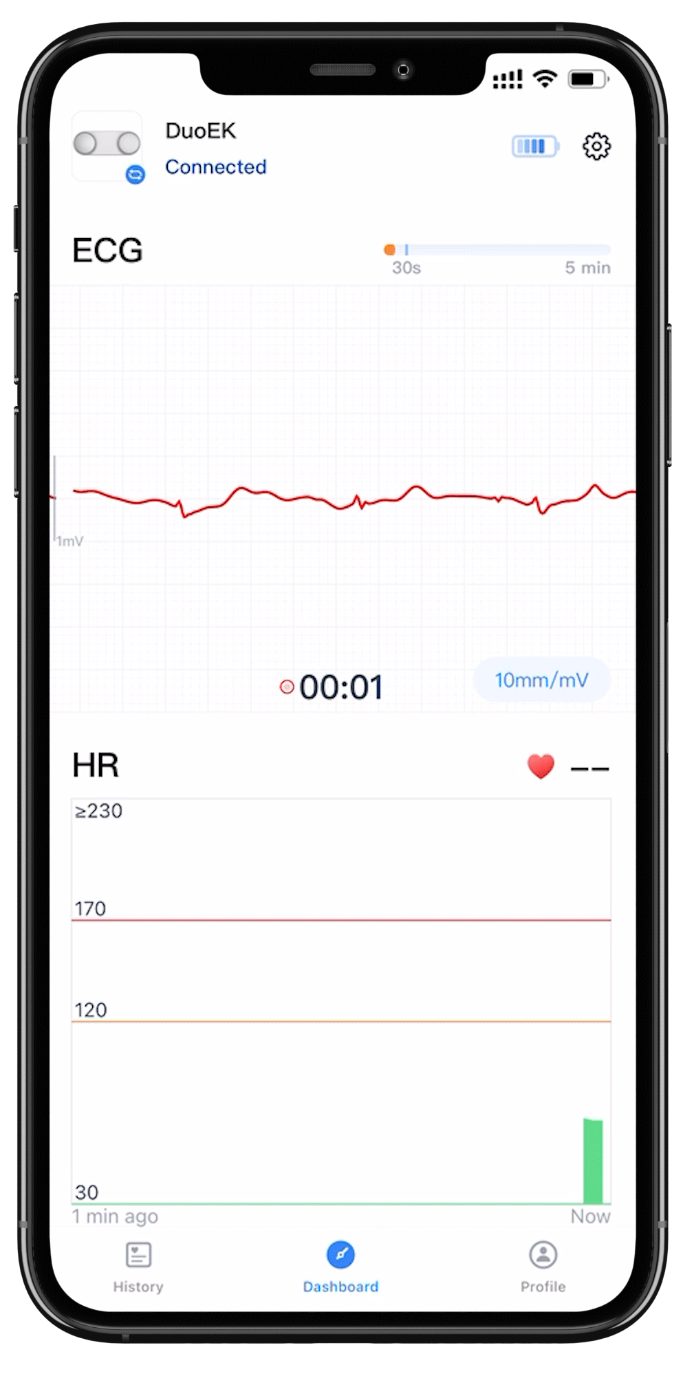 Portable ECG Monitor Get Instant ECGs and Results with Free APP